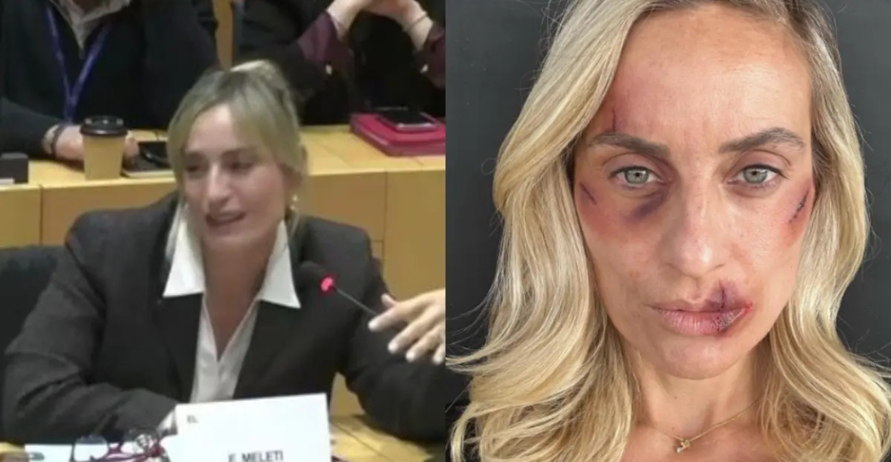 &Epsilon;&lambda;&epsilon;&omicron;&nu;ώ&rho;&alpha; &Mu;&epsilon;&lambda;έ&tau;&eta;: &Xi;έ&sigma;&pi;&alpha;&sigma;&epsilon; &sigma;&epsilon; &kappa;&lambda;ά&mu;&alpha;&tau;&alpha; &kappa;&alpha;&iota; &alpha;&pi;&omicron;&kappa;ά&lambda;&upsilon;&psi;&epsilon; &mu;&epsilon; &tau;&rho;&epsilon;&mu;ά&mu;&epsilon;&nu;&eta; &phi;&omega;&nu;ή &pi;&omega;&sigmaf; έ&pi;&epsilon;&sigma;&epsilon; &theta;ύ&mu;&alpha; &kappa;&alpha;&kappa;&omicron;&pi;&omicron;ί&eta;&sigma;&eta;&sigmaf; &alpha;&pi;ό &sigma;&chi;έ&sigma;&eta; &tau;&eta;&sigmaf;