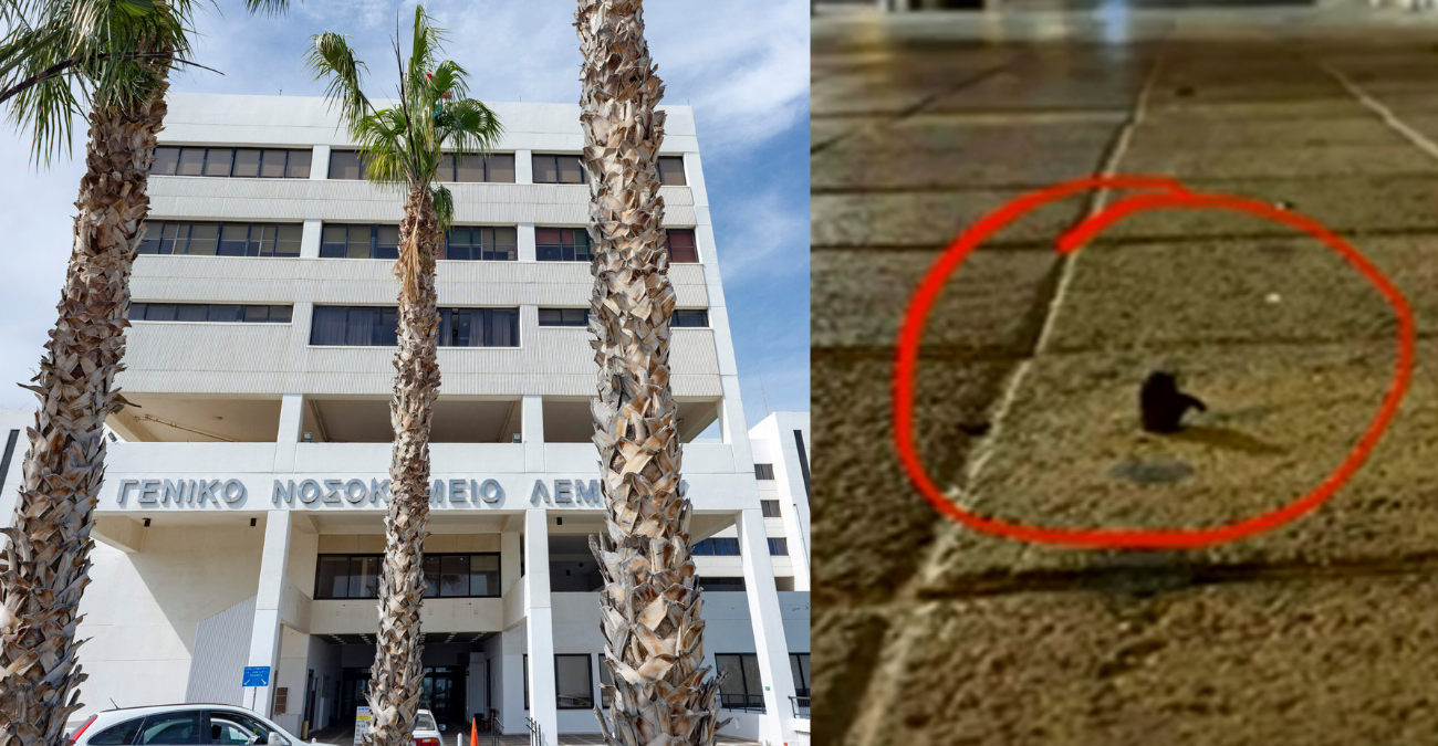 VIDEO: Σκόνταψε σε σίδερο που προεξείχε σε πεζοδρόμιο και μπήκε χειρουργείο – Η ταλαιπωρία στο Γ.Ν.Λεμεσού