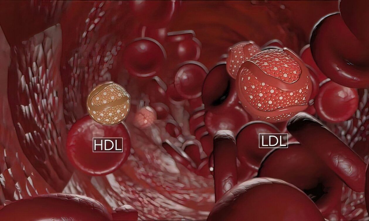 Γιατί μερικοί άνθρωποι έχουν υψηλή χοληστερόλη παρά τον υγιεινό τρόπο ζωής; Τι λένε οι ειδικοί, τα νέα ευρήματα