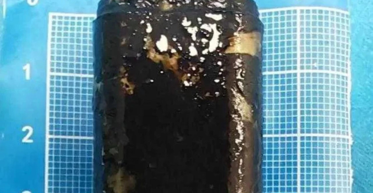 Κατάπιε αναπτήρα για challenge και 30 χρόνια μετά λειτουργούσε