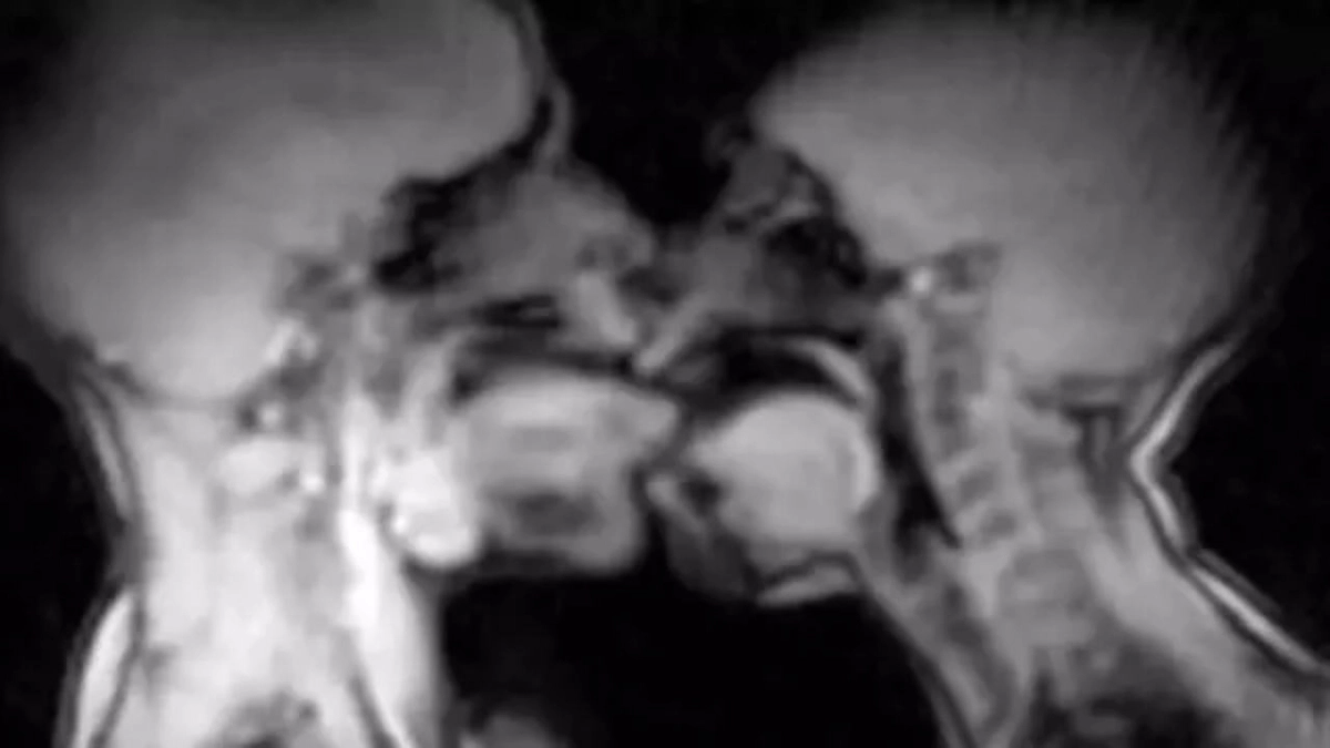 Έ&kappa;&alpha;&nu;&alpha;&nu; &sigma;&epsilon;&xi; &mu;έ&sigma;&alpha; &sigma;&epsilon; &mu;&alpha;&gamma;&nu;&eta;&tau;&iota;&kappa;ό &tau;&omicron;&mu;&omicron;&gamma;&rho;ά&phi;&omicron; &kappa;&alpha;&iota;...&kappa;&alpha;&tau;έ&lambda;&eta;&xi;&alpha;&nu; &sigma;&epsilon; &epsilon;&pi;&iota;&sigma;&tau;&eta;&mu;&omicron;&nu;&iota;&kappa;ή &alpha;&nu;&alpha;&kappa;ά&lambda;&upsilon;&psi;&eta; - &Tau;&iota; έ&delta;&epsilon;&iota;&xi;&alpha;&nu; &omicron;&iota; &epsilon;&iota;&kappa;ό&nu;&epsilon;&sigmaf; &tau;&omicron;&upsilon; MRI