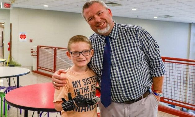 Σχεδίασε πρόσθετο χέρι για ΑμεΑ μαθητή με κόστος… 30 δολάρια