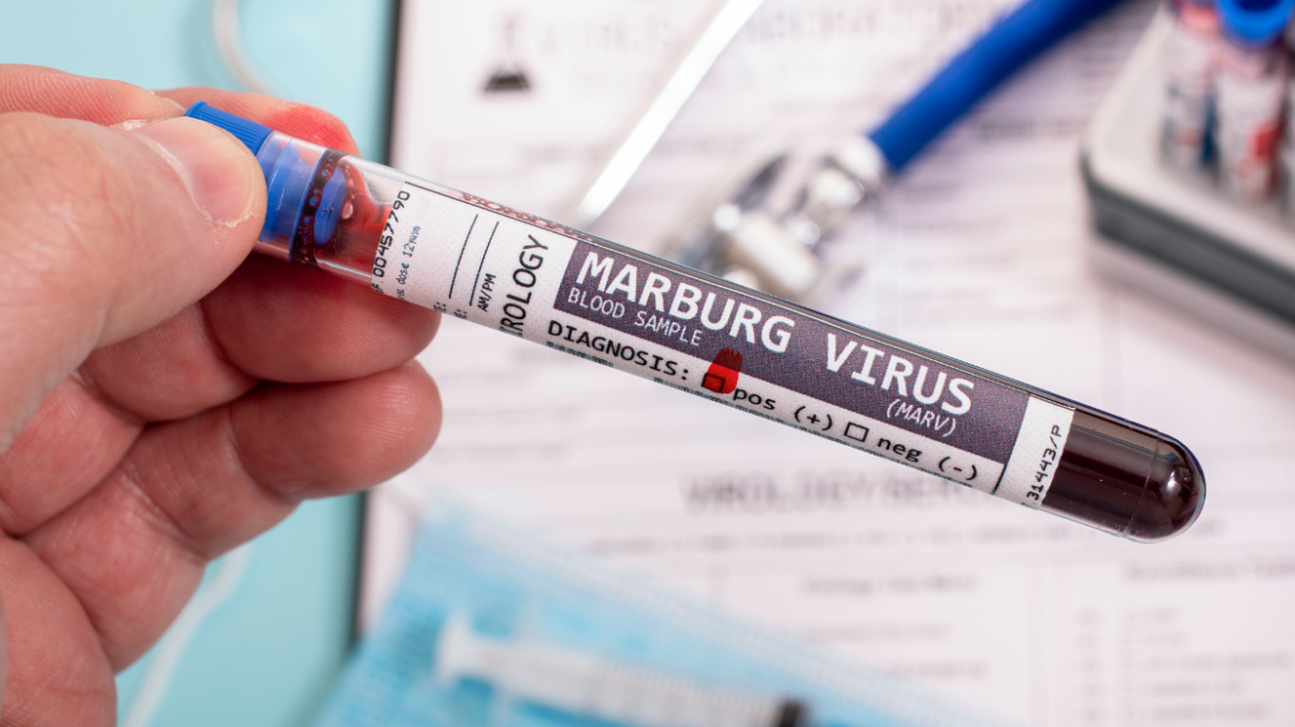 Κρούσματα του θανατηφόρου ιού Marburg ανακοίνωσε η Αιθιοπία