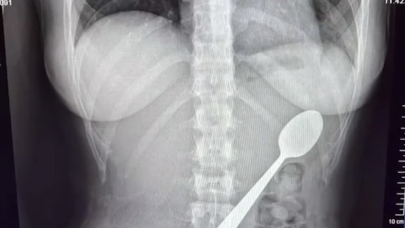 &Mu;&iota;&alpha; 28&chi;&rho;&omicron;&nu;&eta; &sigma;&tau;&omicron; &Beta;έ&lambda;&gamma;&iota;&omicron; &kappa;&alpha;&tau;ά&pi;&iota;&epsilon; &kappa;&omicron;&upsilon;&tau;ά&lambda;&iota; 17 &epsilon;&kappa;&alpha;&tau;&omicron;&sigma;&tau;ώ&nu; ό&tau;&alpha;&nu; &pi;ή&delta;&eta;&xi;&epsilon; &pi;ά&nu;&omega; &tau;&eta;&sigmaf; &omicron; &sigma;&kappa;ύ&lambda;&omicron;&sigmaf; &tau;&eta;&sigmaf;