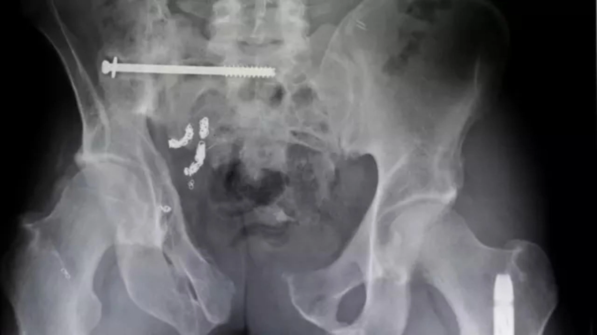 Αυτά είναι τα 25 χειρότερα πράγματα που κόλλησαν σε οπίσθια ανθρώπων το 2025 - Δεν θα πιστεύετε