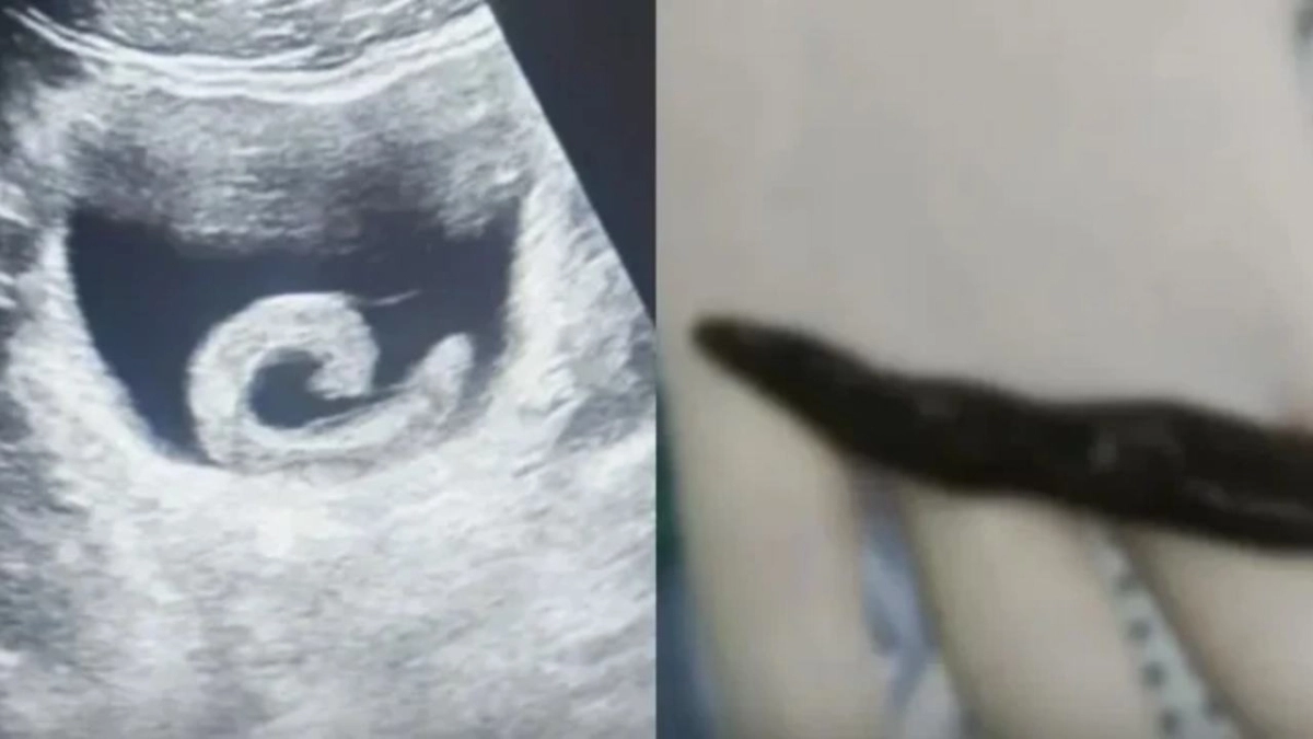 Έ&beta;&alpha;&lambda;&epsilon; &zeta;&omega;&nu;&tau;&alpha;&nu;ή &beta;&delta;έ&lambda;&lambda;&alpha; &sigma;&tau;&eta;&nu; &omicron;&upsilon;&rho;&omicron;&delta;ό&chi;&omicron; &kappa;ύ&sigma;&tau;&eta; &tau;&omicron;&upsilon; &gamma;&iota;&alpha; &laquo;&pi;&alpha;&rho;&alpha;&delta;&omicron;&sigma;&iota;&alpha;&kappa;ή &theta;&epsilon;&rho;&alpha;&pi;&epsilon;ί&alpha;&raquo;: &Kappa;&alpha;&tau;έ&lambda;&eta;&xi;&epsilon; &sigma;&tau;&omicron; &chi;&epsilon;&iota;&rho;&omicron;&upsilon;&rho;&gamma;&epsilon;ί&omicron; &mu;&epsilon; &phi;&rho;&iota;&kappa;&tau;&omicron;ύ&sigmaf; &pi;ό&nu;&omicron;&upsilon;&sigmaf;