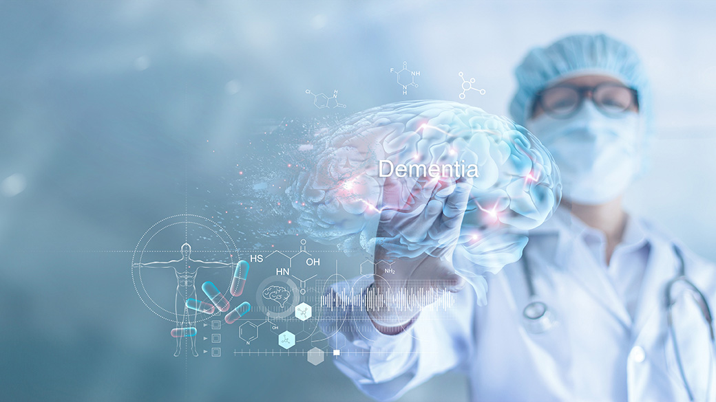 Ανευρύσματα Εγκεφάλου: Τα επικίνδυνα συμπτώματα – Οι τεχνικές αντιμετώπισης